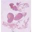 Assises25_Cas5-1_Gyneco_SC